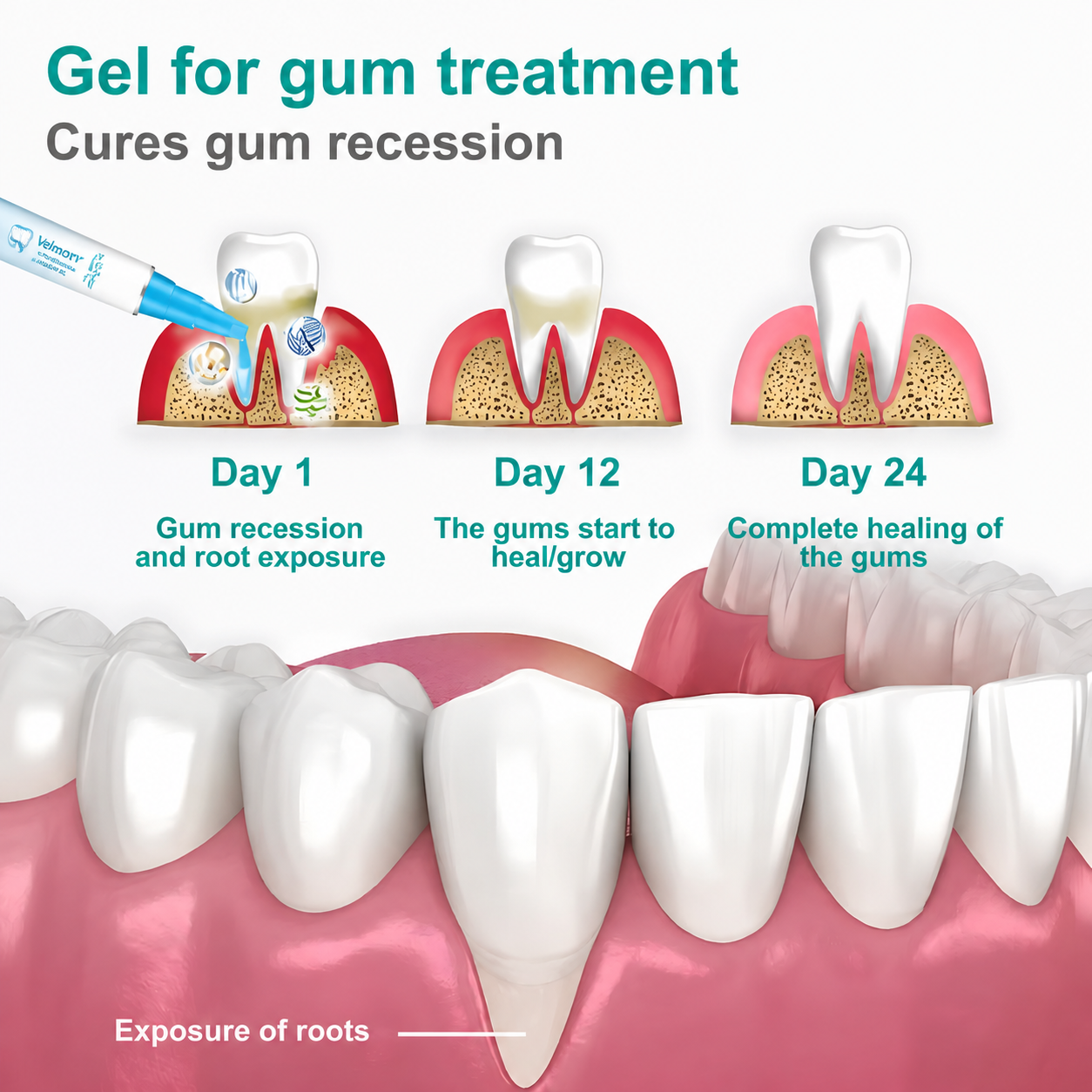 Velmorv® Gum Protect Repair Gel