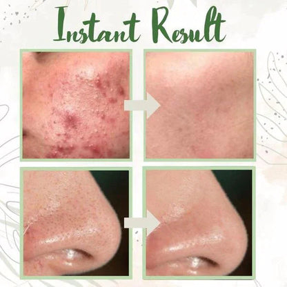 Velmorv® Green Tea Pore Reset Mask Stick