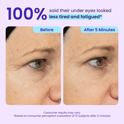 Eye Bag Instant Eraser, Tightens, Firms, & Blurs Wrinkles (Copy)