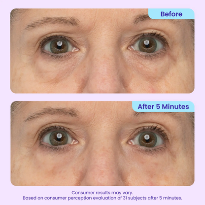 Eye Bag Instant Eraser, Tightens, Firms, & Blurs Wrinkles (Copy)