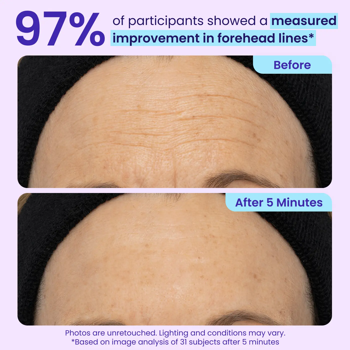 Eye Bag Instant Eraser, Tightens, Firms, & Blurs Wrinkles (Copy)