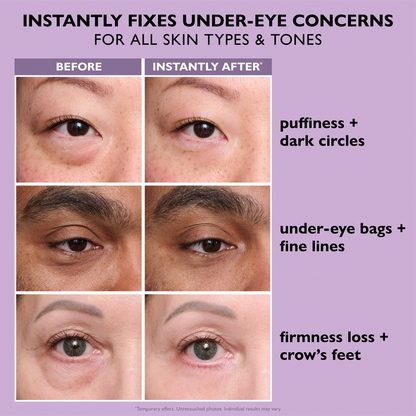 Eye Bag Instant Eraser, Tightens, Firms, & Blurs Wrinkles (Copy)