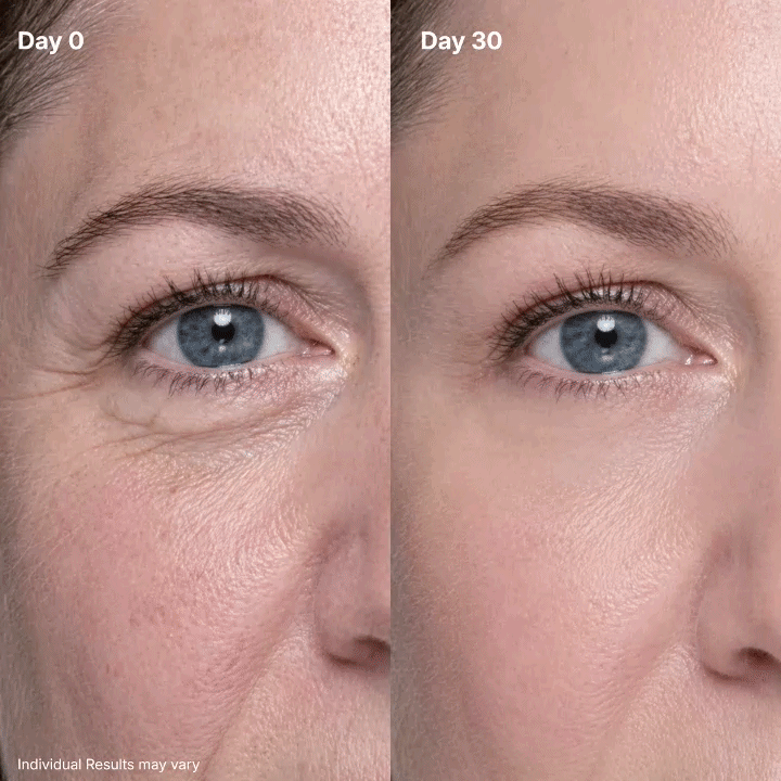 🔥 2-HOUR FLASH SALE: 50% OFF Clinclii P7 Eye Cream! ⏳✨